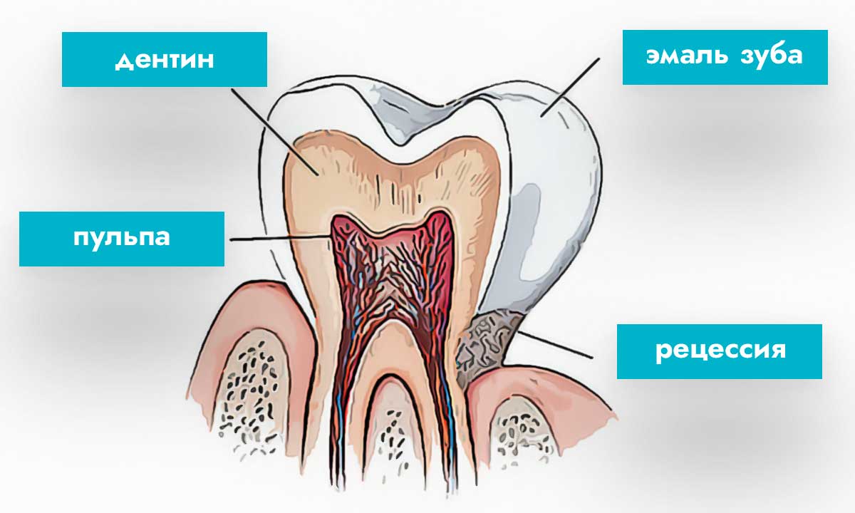 причины чувствительности зубов