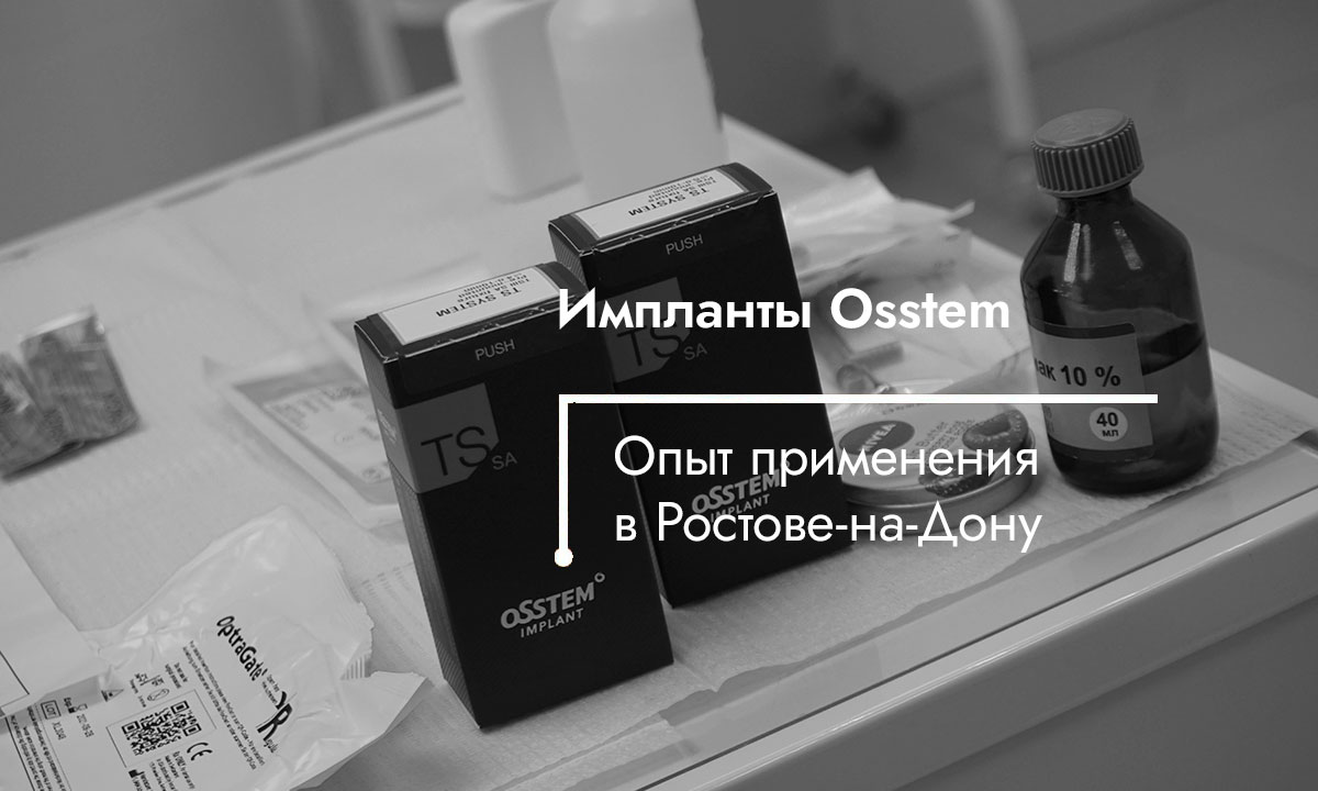 Импланты Osstem (Осстем) в Ростове-на-Дону