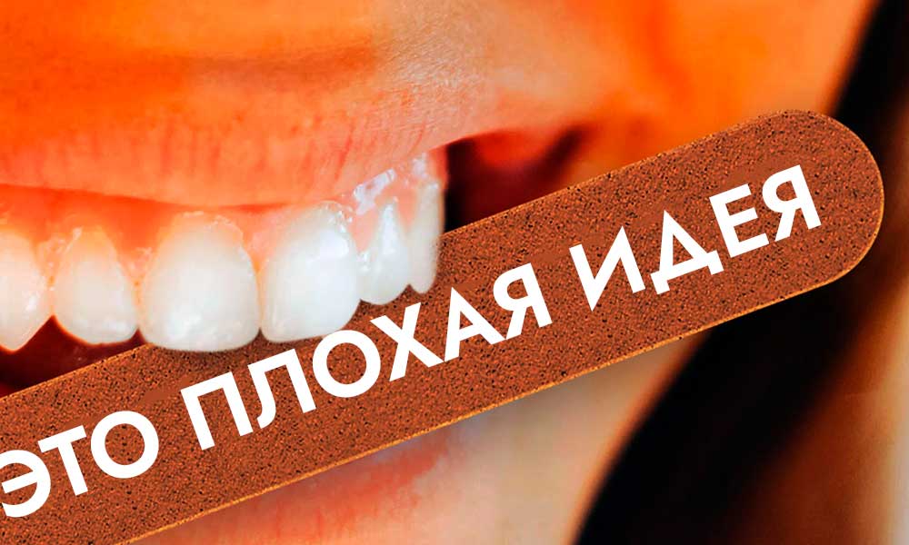 подпиливание зубов самостоятельно запрещено