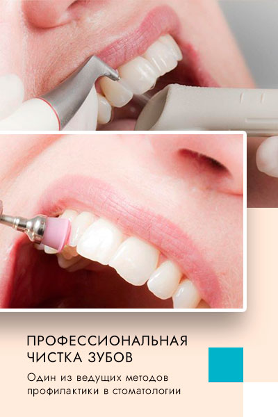 профилактика заболеваний в стоматологии