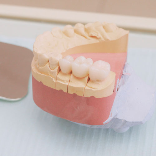 скидка на лечение перед протезированием зубов