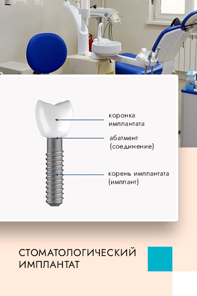 стоматологические имплантаты